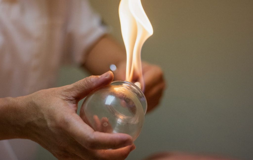 Fire cupping therapy